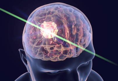 術(shù)中成像用藍寶石